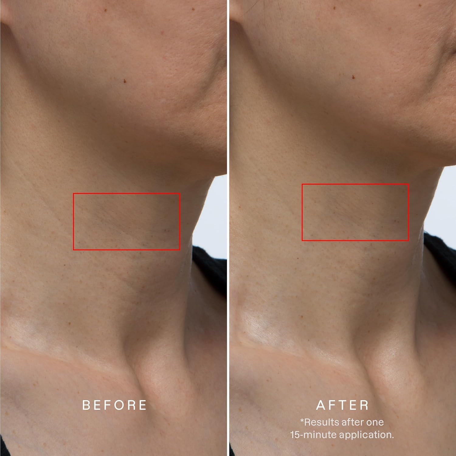 Karuna hydrogel close-up texture highlighting cooling, moisture-holding formula