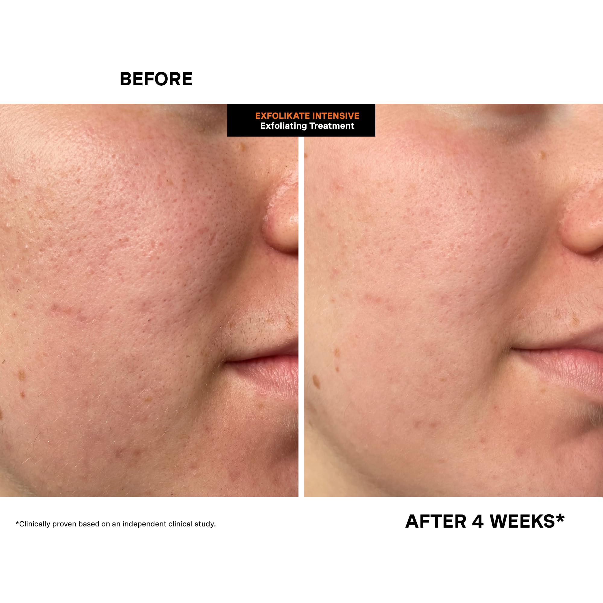 Kate Somerville product on hand demonstrating application and easy spreadability benefit
