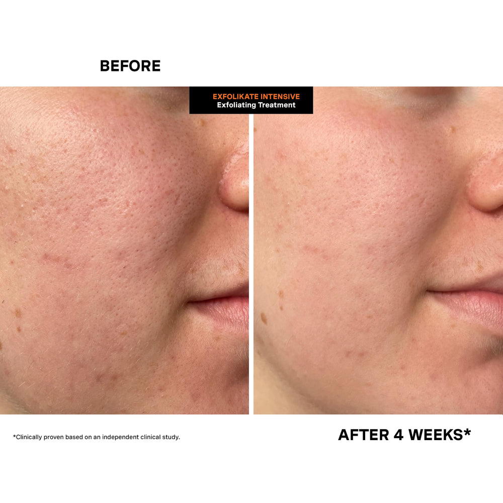 Kate Somerville product on hand demonstrating application and easy spreadability benefit