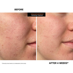Kate Somerville product on hand demonstrating application and easy spreadability benefit