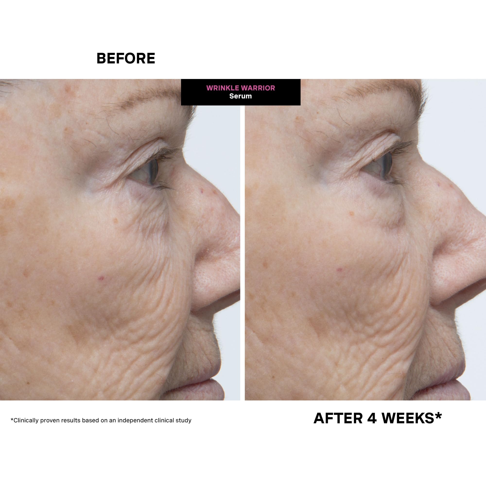 Kate Somerville before and after image showing temporary visible smoothing