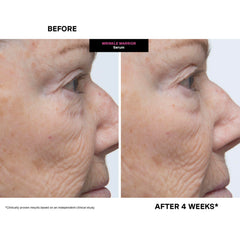 Kate Somerville before and after image showing temporary visible smoothing