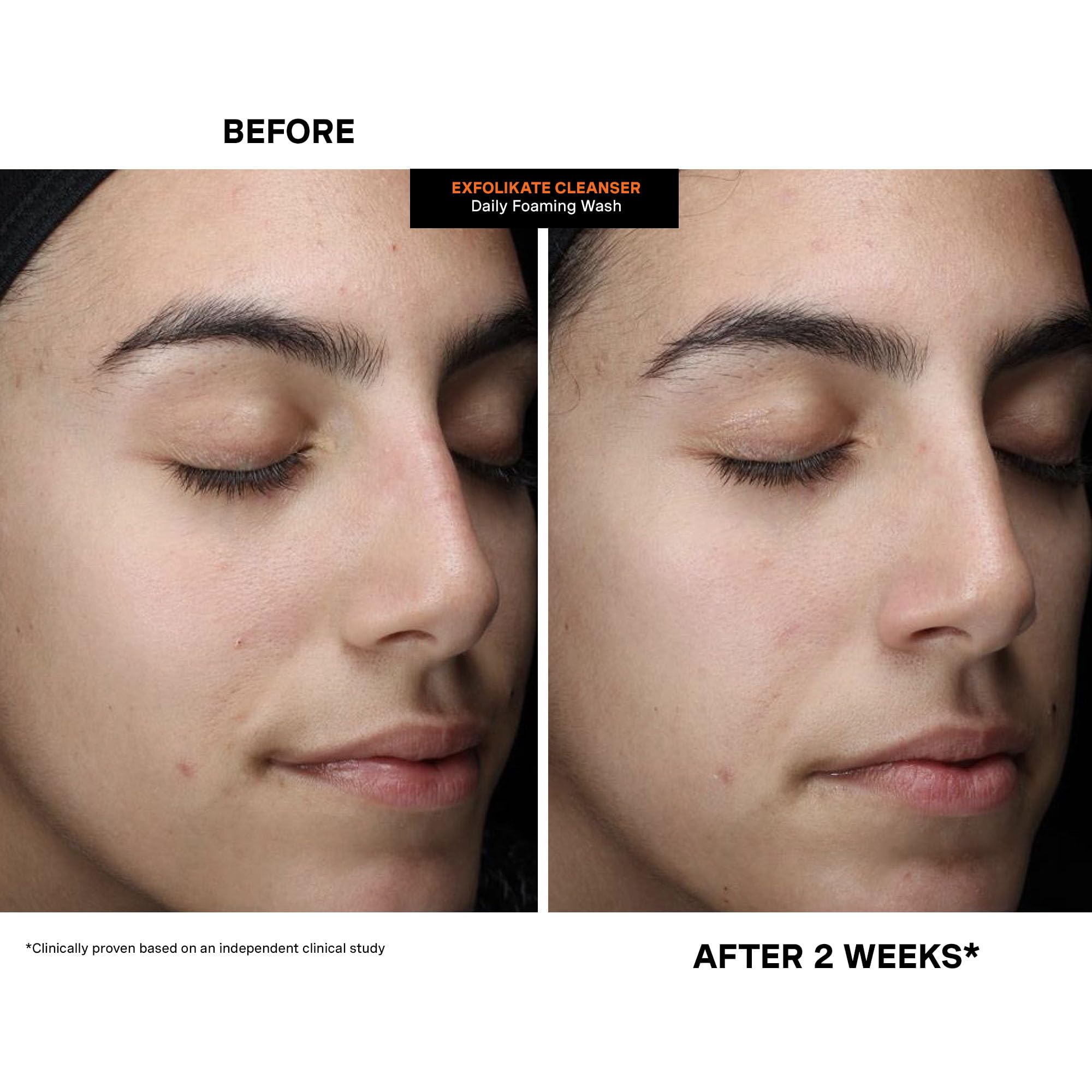 Product packaging and box detail highlighting clinic-to-home formulation benefit