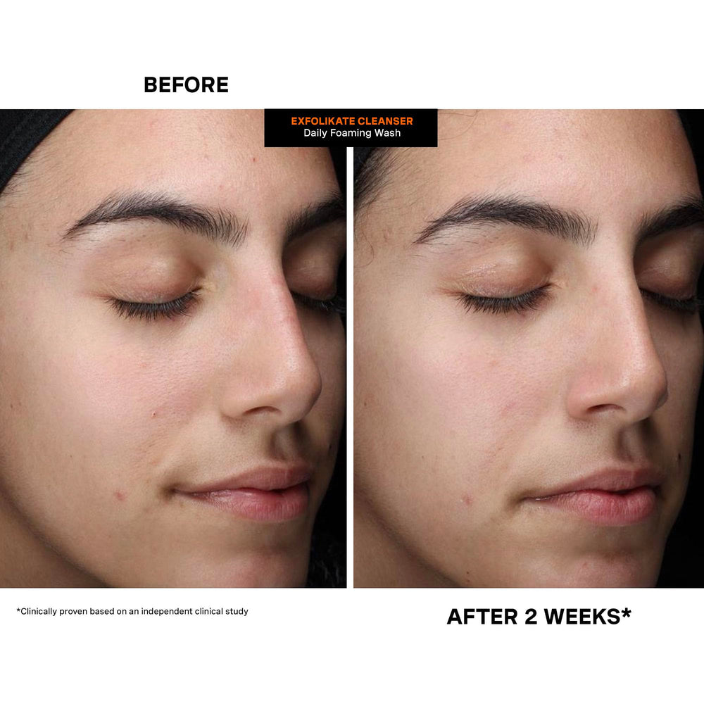 Kate Somerville droplet of cleanser on fingertip revealing texture and spreadability benefit