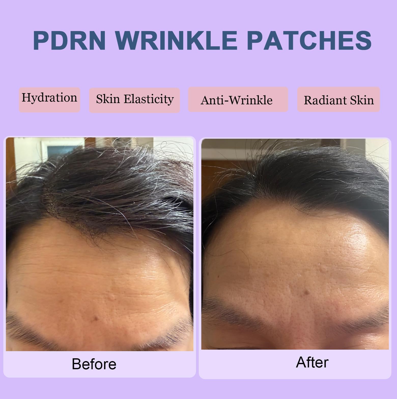 Kewhunt patch applied to forehead in use for overnight smoothing and hydration