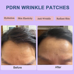 Kewhunt patch applied to forehead in use for overnight smoothing and hydration