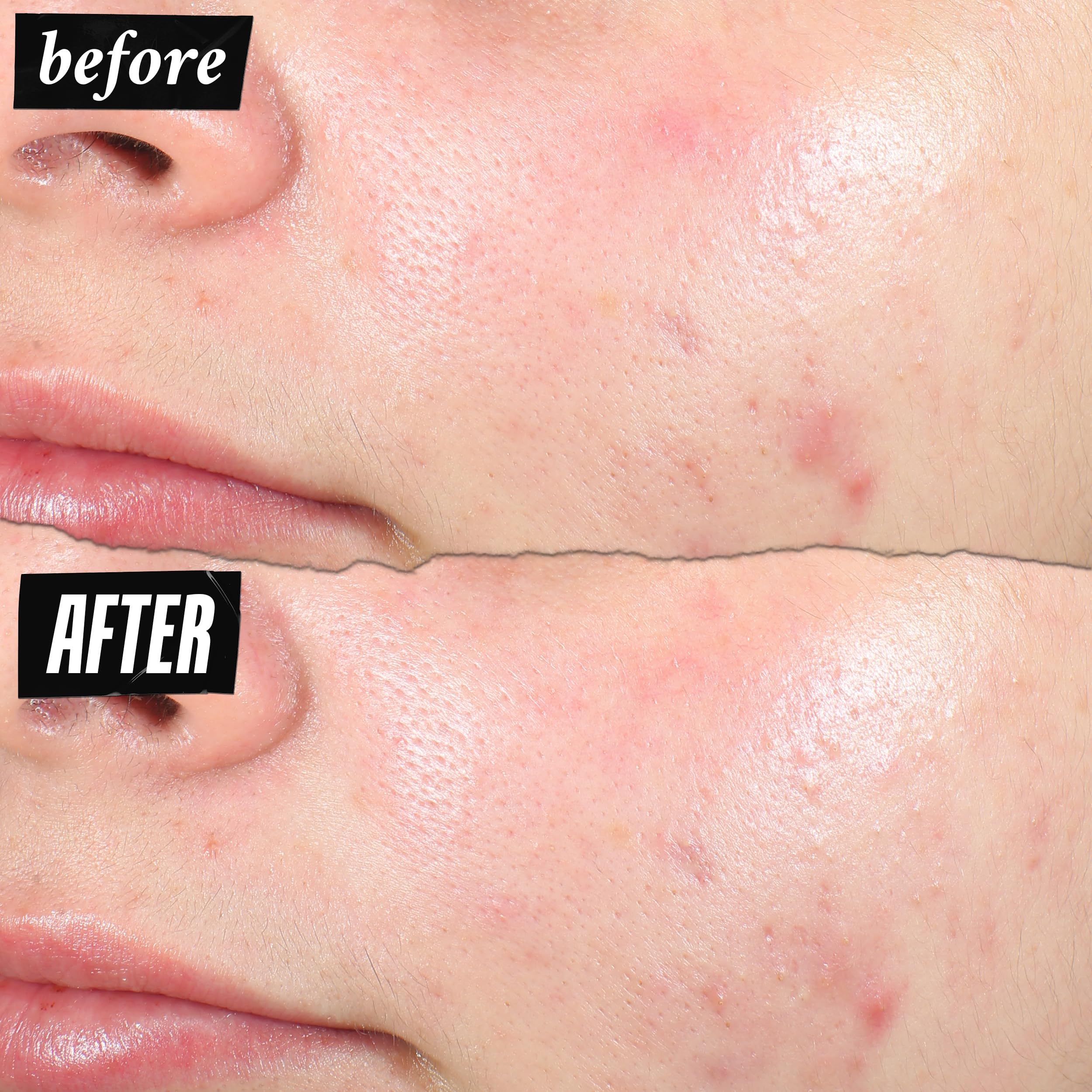 Kiehl's before and after spot illustration showing reduced redness and size