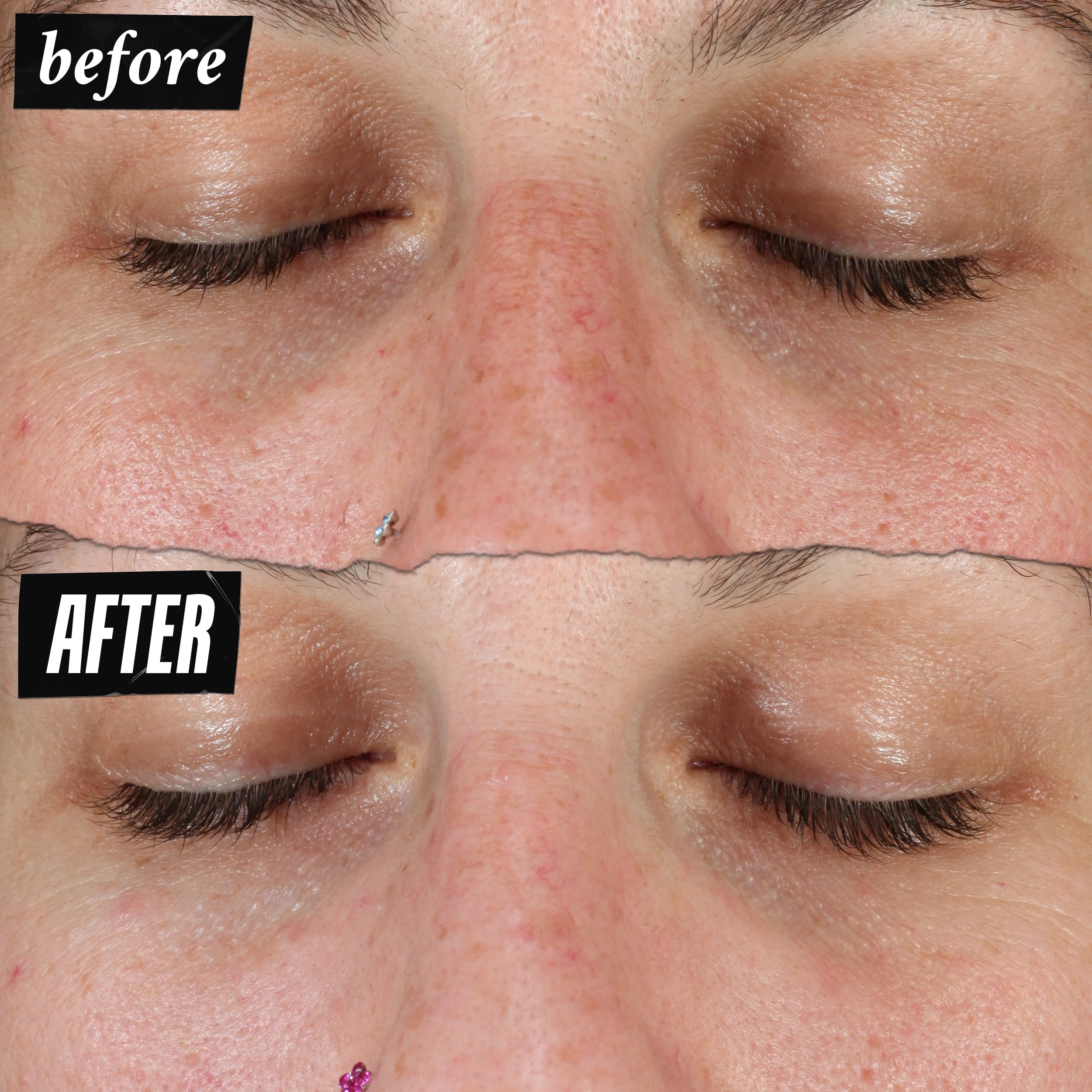 Kiehl's before and after comparison suggesting improved skin clarity