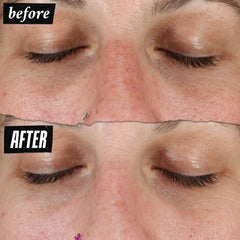 Kiehl's before and after comparison suggesting improved skin clarity