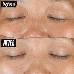 Kiehl's Activated C ingredient graphic illustrating targeted brightening benefit