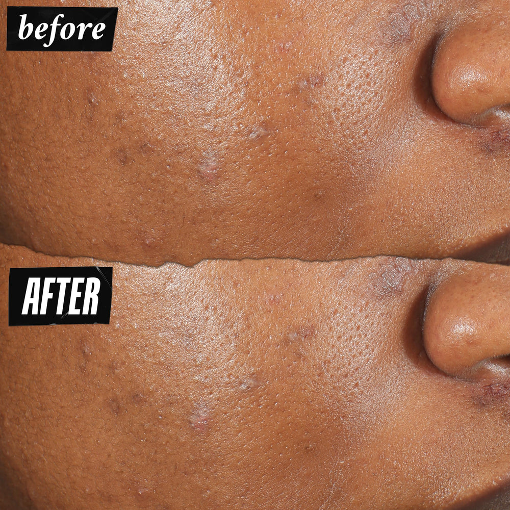 Kiehl's ingredient label highlighting salicylic acid and niacinamide for clearer skin