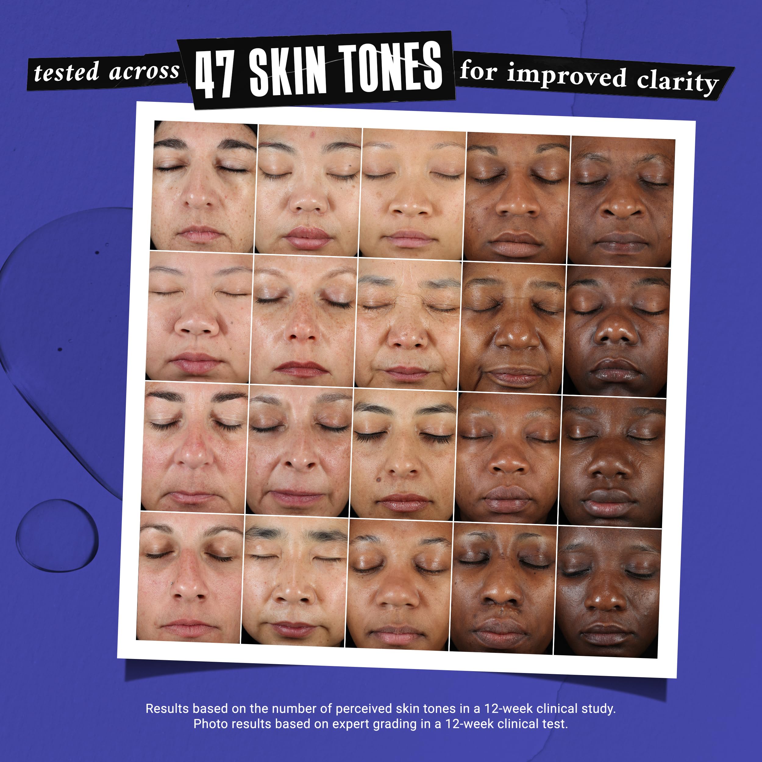 Kiehl's conceptual before-and-after spot treatment highlighting visible clarity benefit