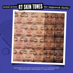 Kiehl's conceptual before-and-after spot treatment highlighting visible clarity benefit