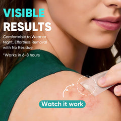 kindshine patch on forehead demonstrating discreet protection benefit
