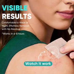 kindshine patch applied to cheek reducing redness visibly