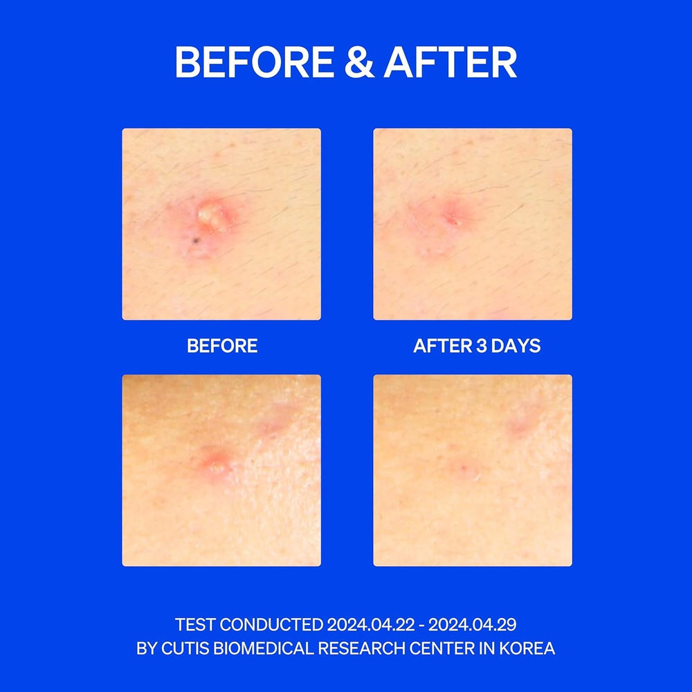 KNEMO patch on face low-profile daytime wear for discreet protection