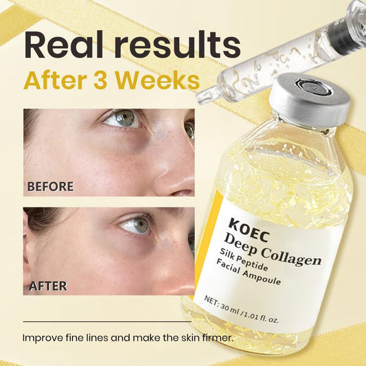 KOEC syringe dispenser inserted into ampoule showing precise dosing benefit