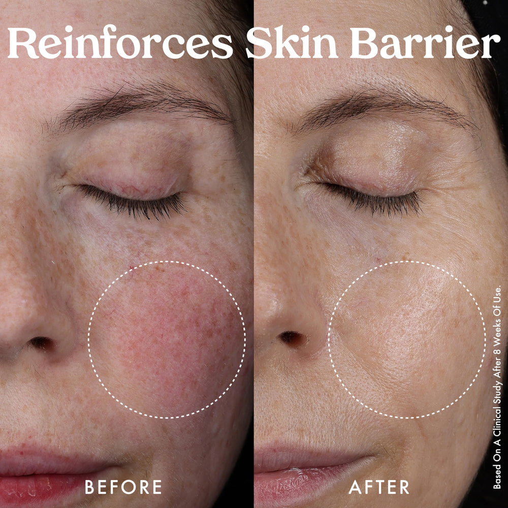 Kopari applying serum to cheek demonstrating hydration and smoothing effect
