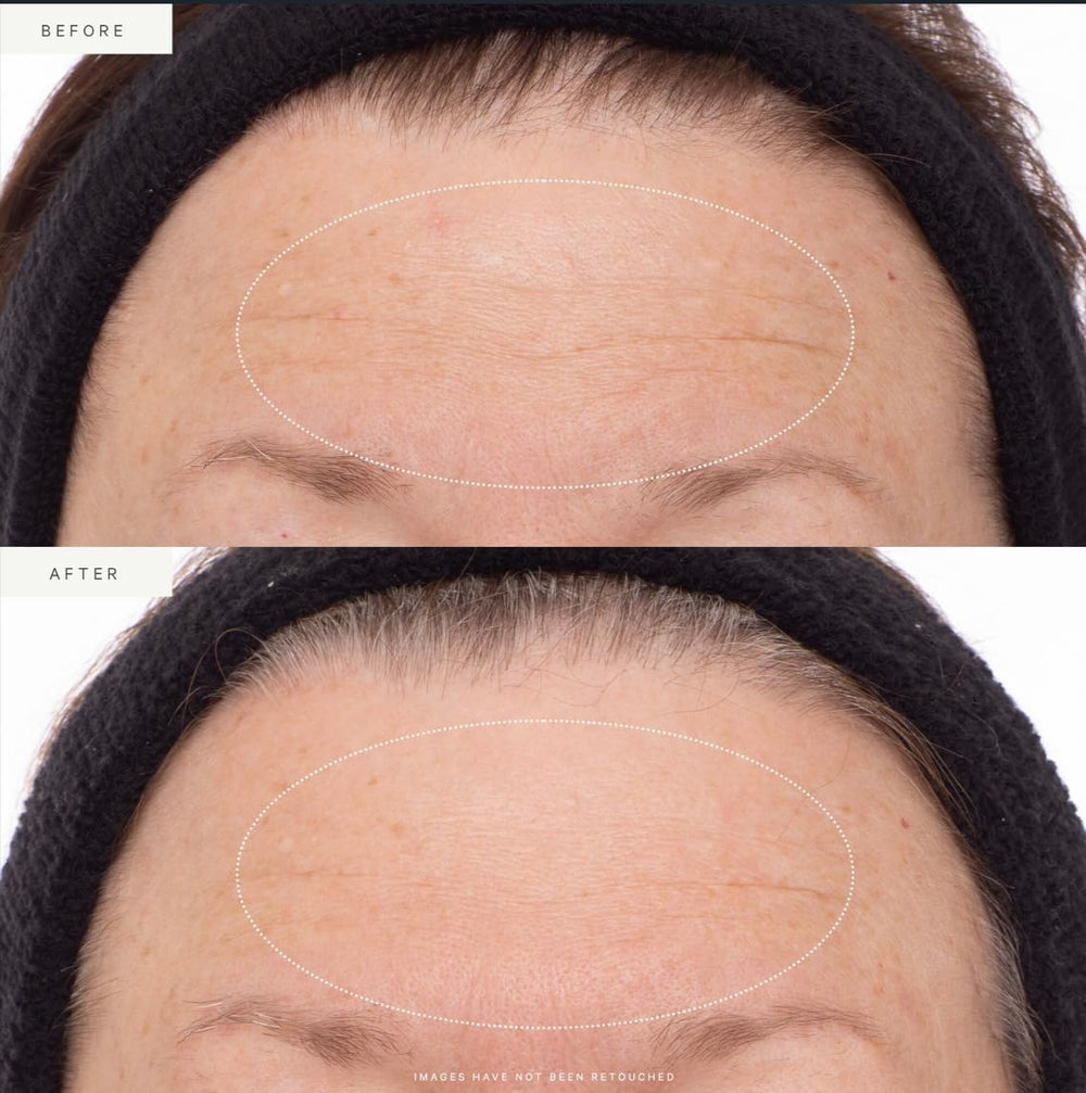 KORA Organics pipette dispensing serum illustrating controlled application