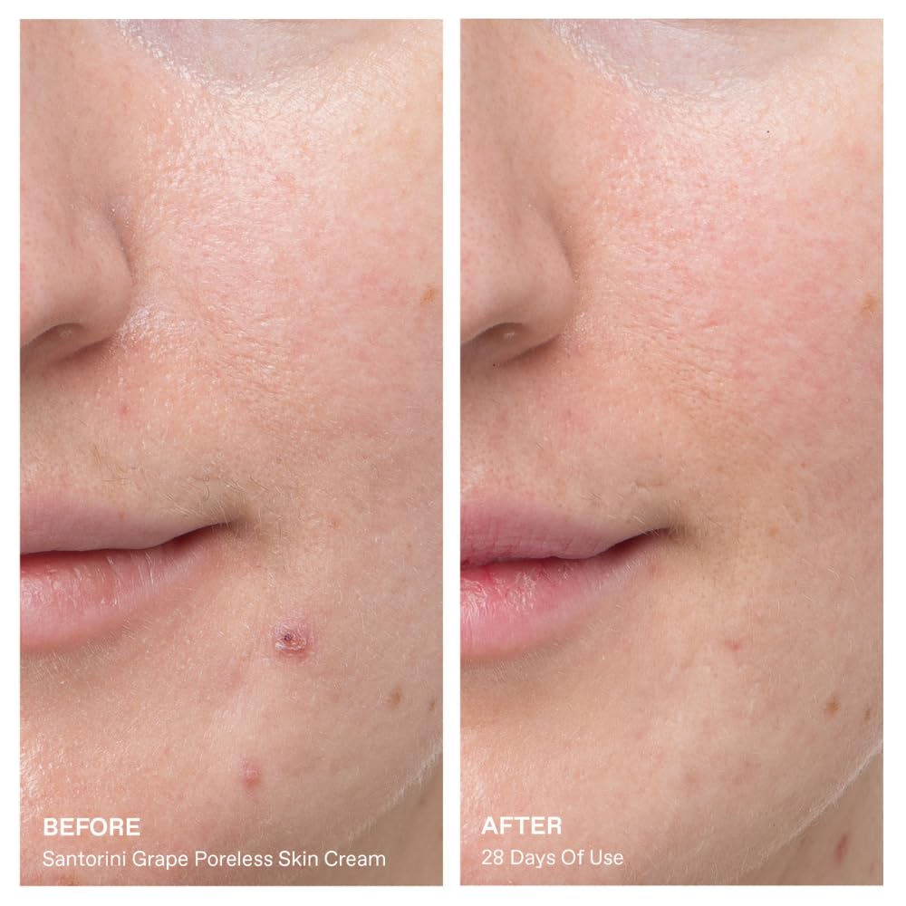 KORRES jar open with gel-cream visible to show smooth application benefit