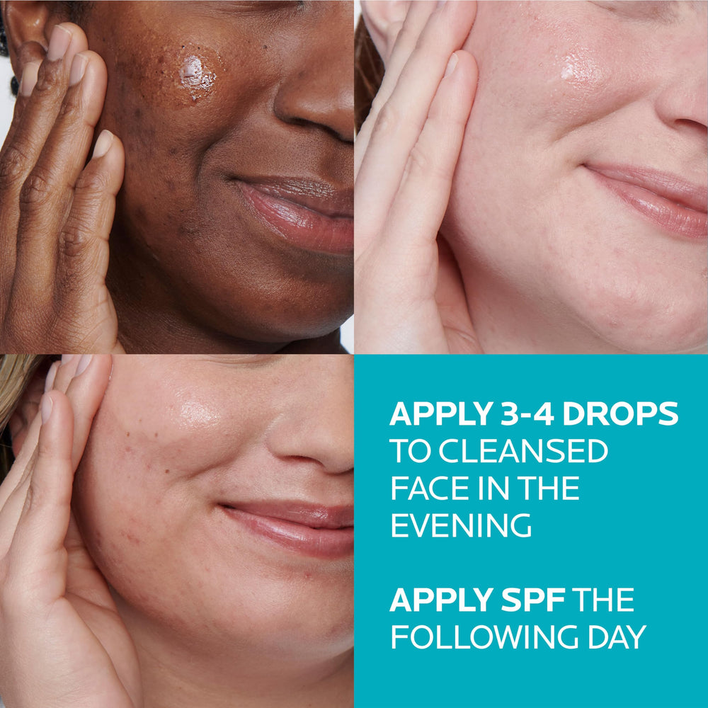 La Roche-Posay before and after scale view showing improved pore appearance