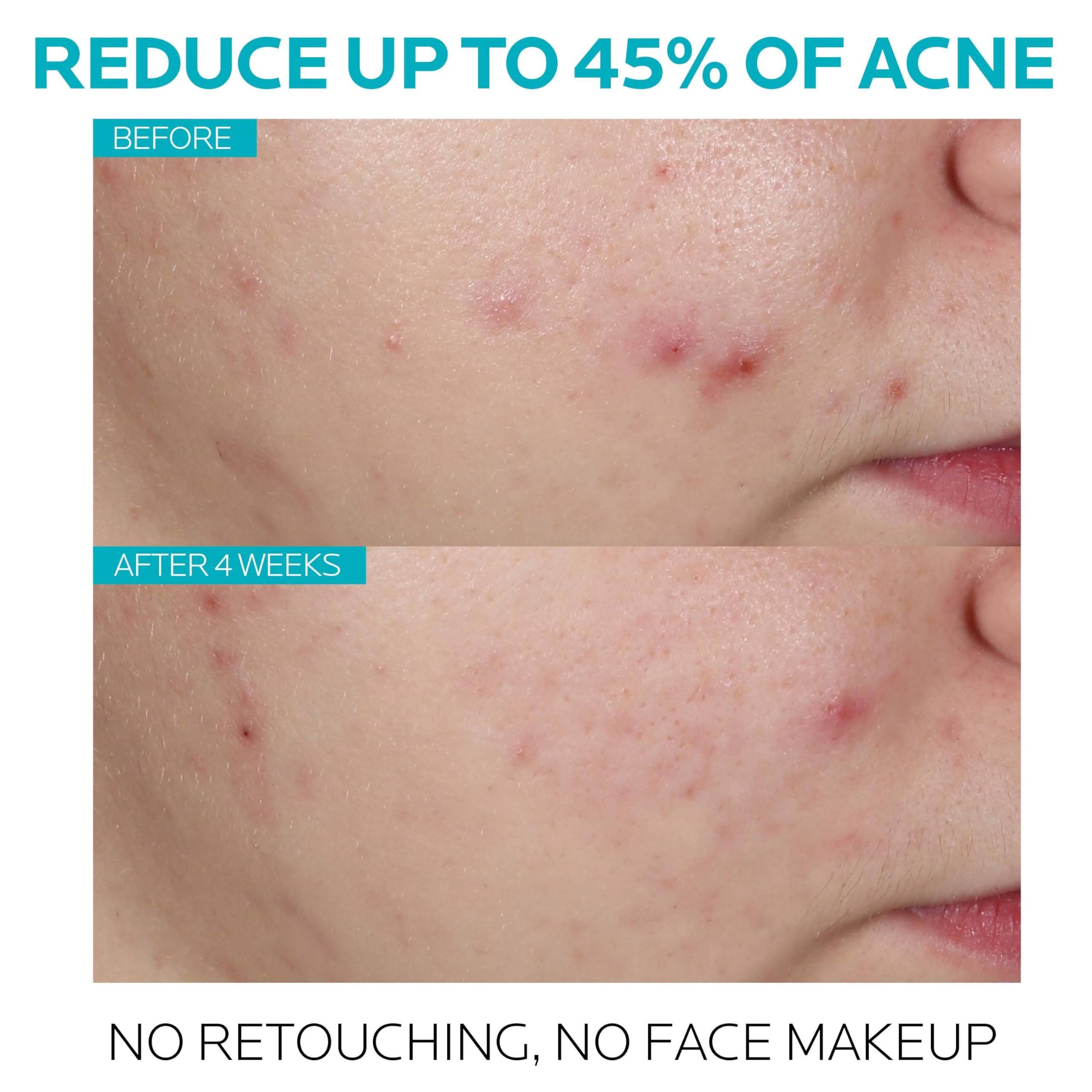 La Roche-Posay serum texture on fingertip illustrating lightweight spreadability