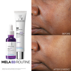 La Roche-Posay bottle closeup emphasizing premium formulation benefit