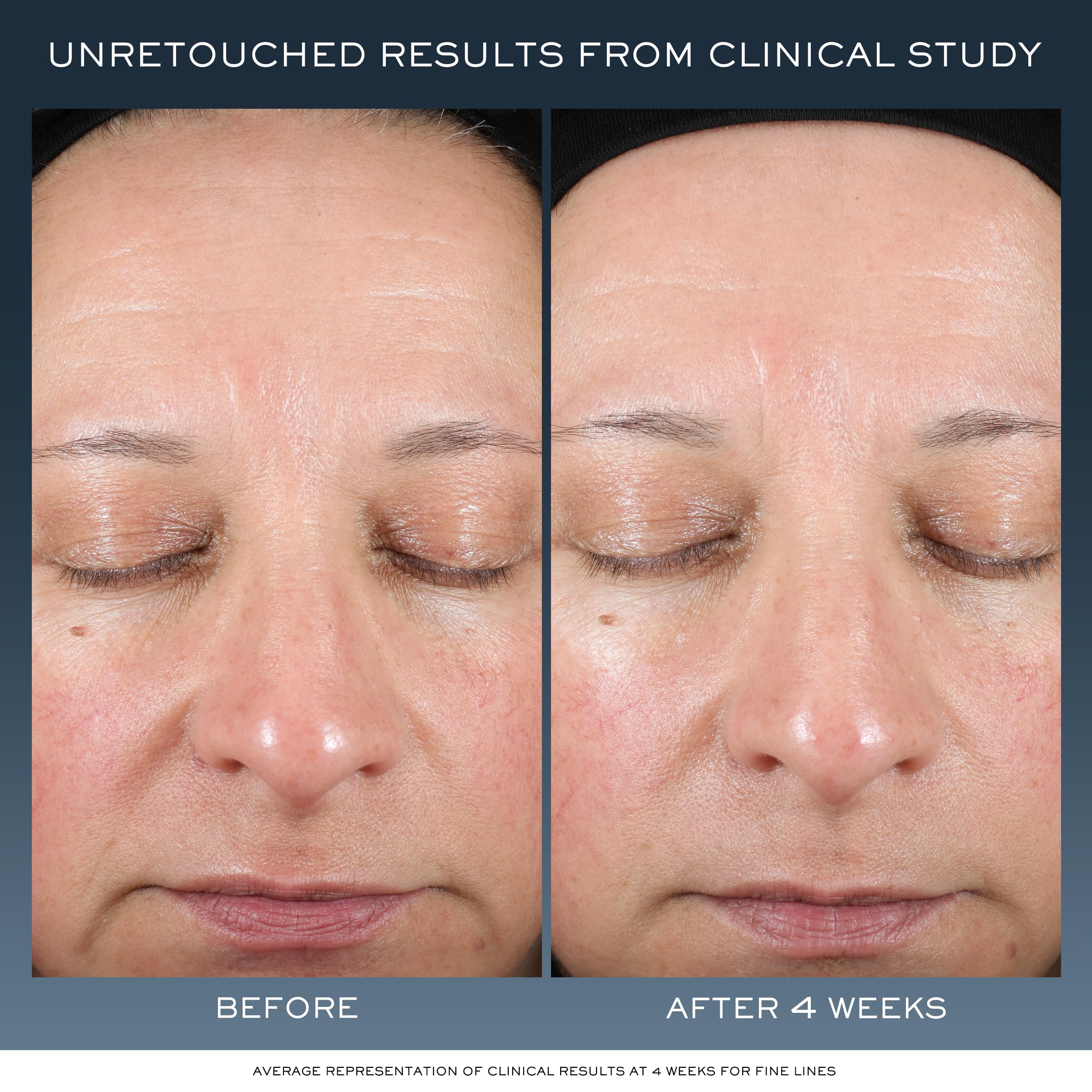 Lancôme cream texture close-up melting on skin, demonstrates smooth absorption