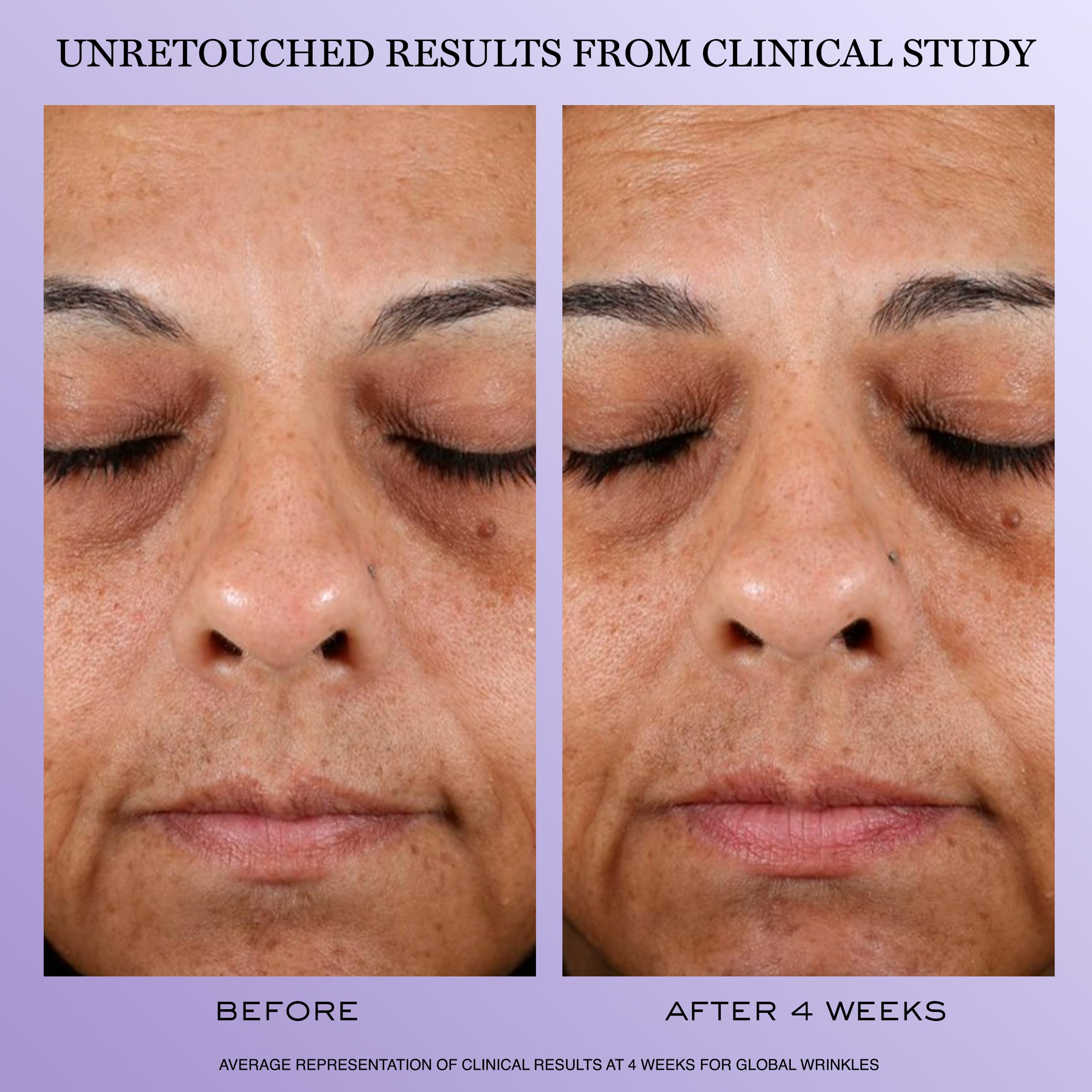 Lancôme close-up of cream surface highlighting peptide-rich texture for smoother look