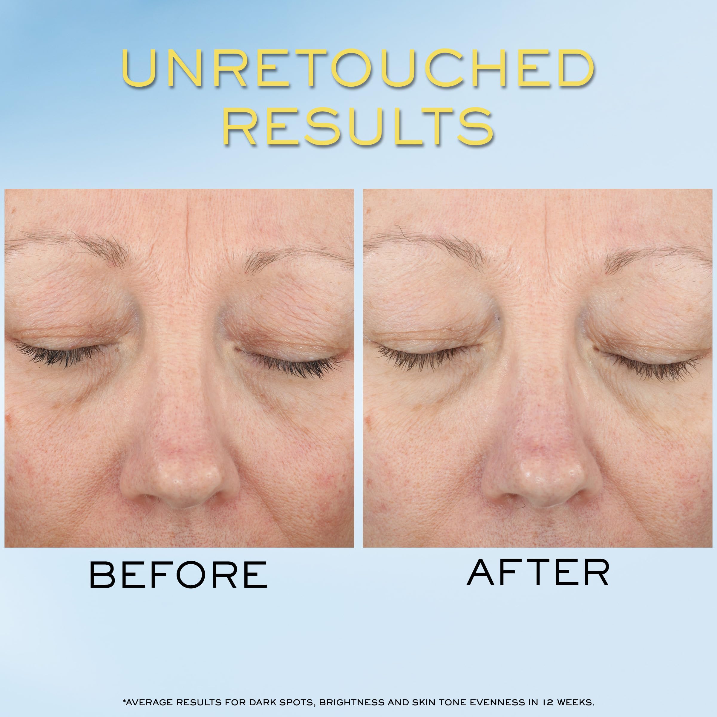 Lancôme visual of niacinamide vitamin Cg and hyaluronic acid benefits on skin
