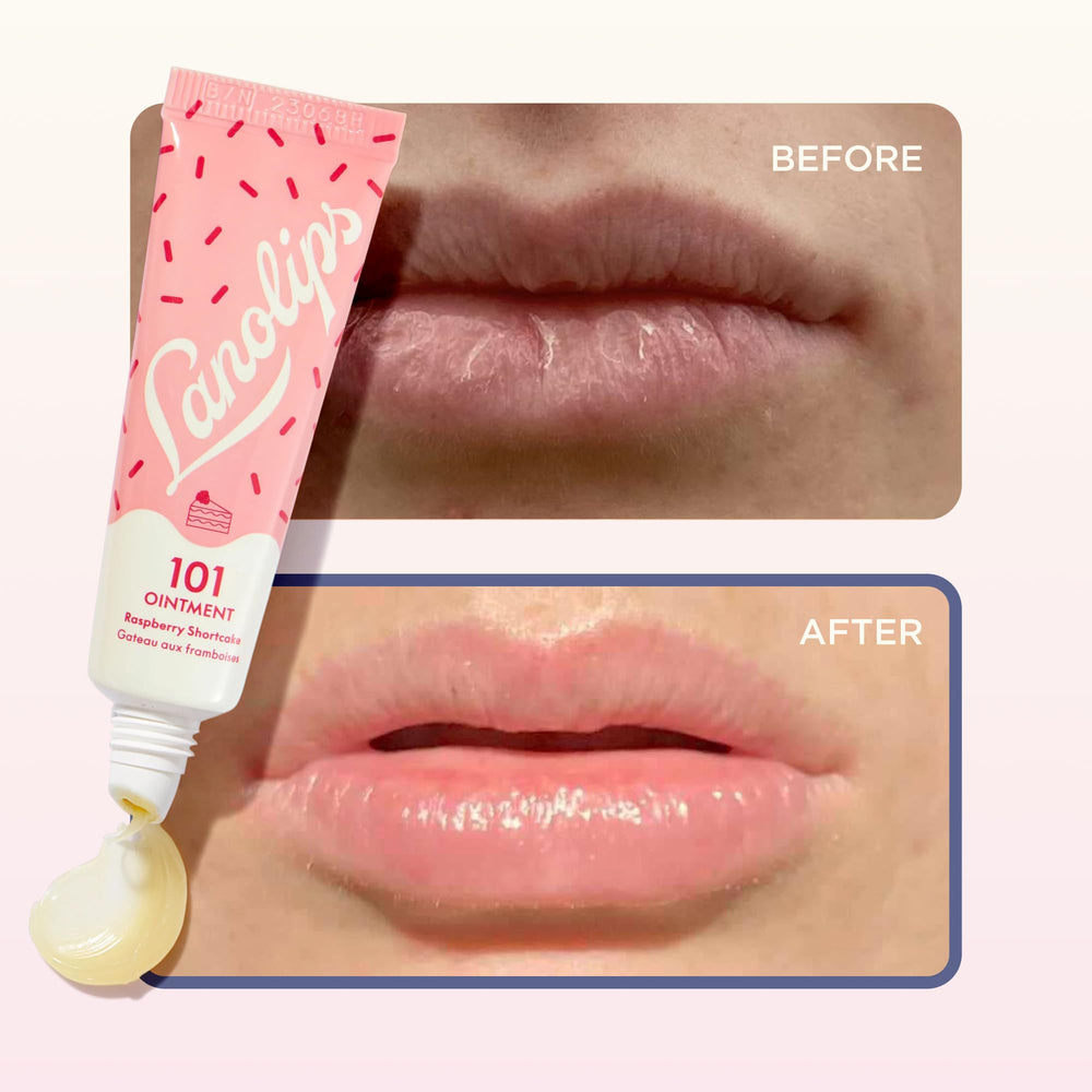 Lanolips used on cuticles and elbow showing multitask hydration benefit