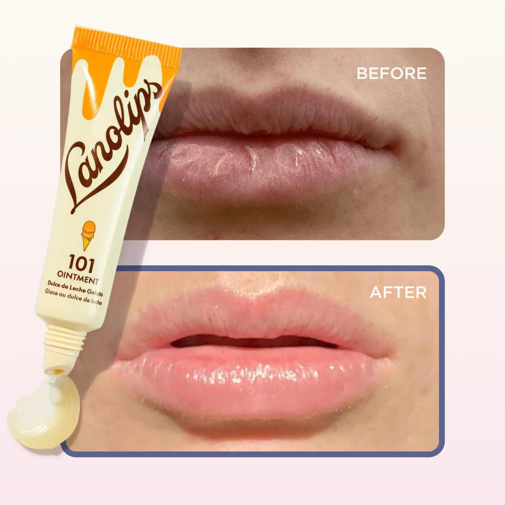 Lanolips applied to elbow dry patch providing barrier and hydration