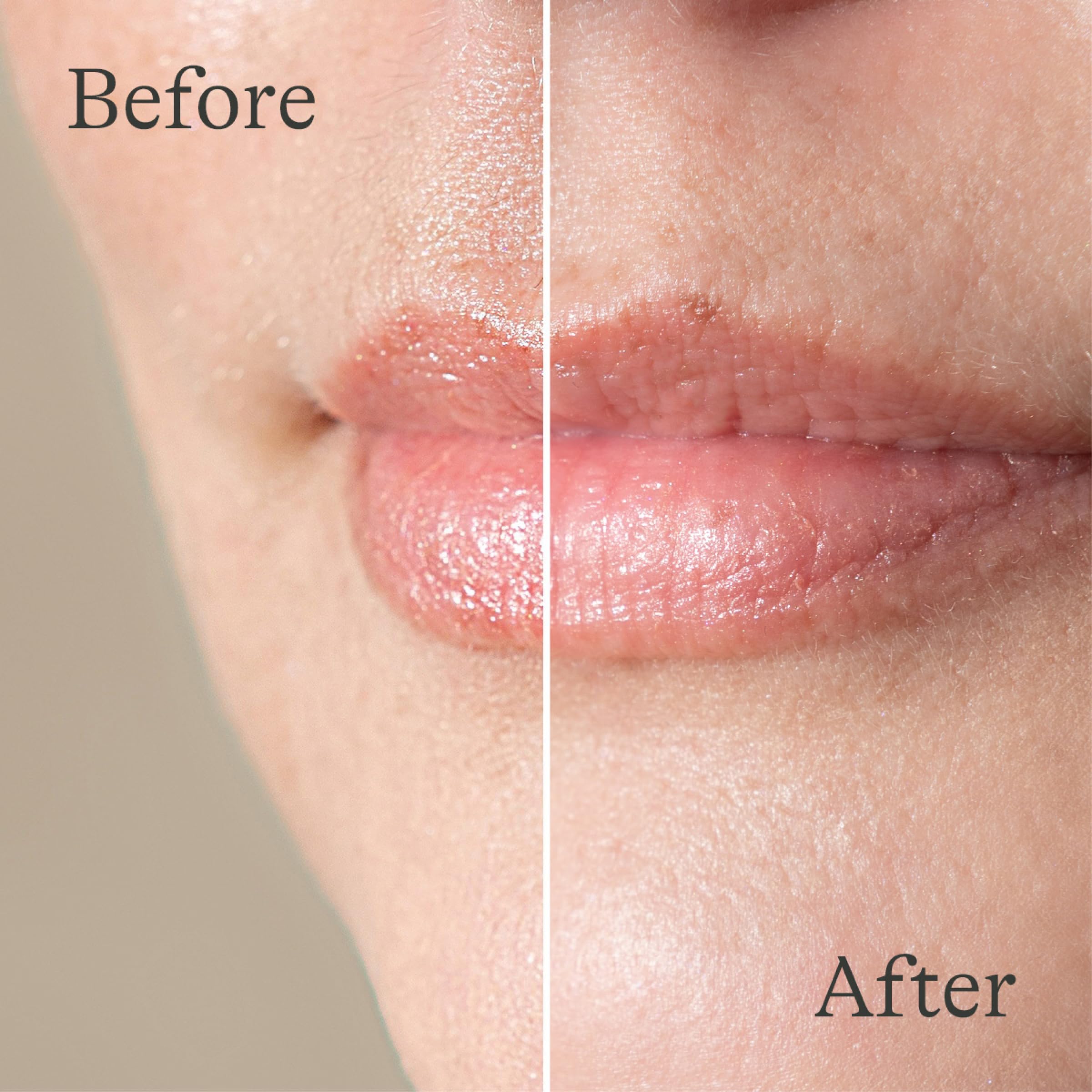 Lansinoh before and after lips demonstrating visible smoothing
