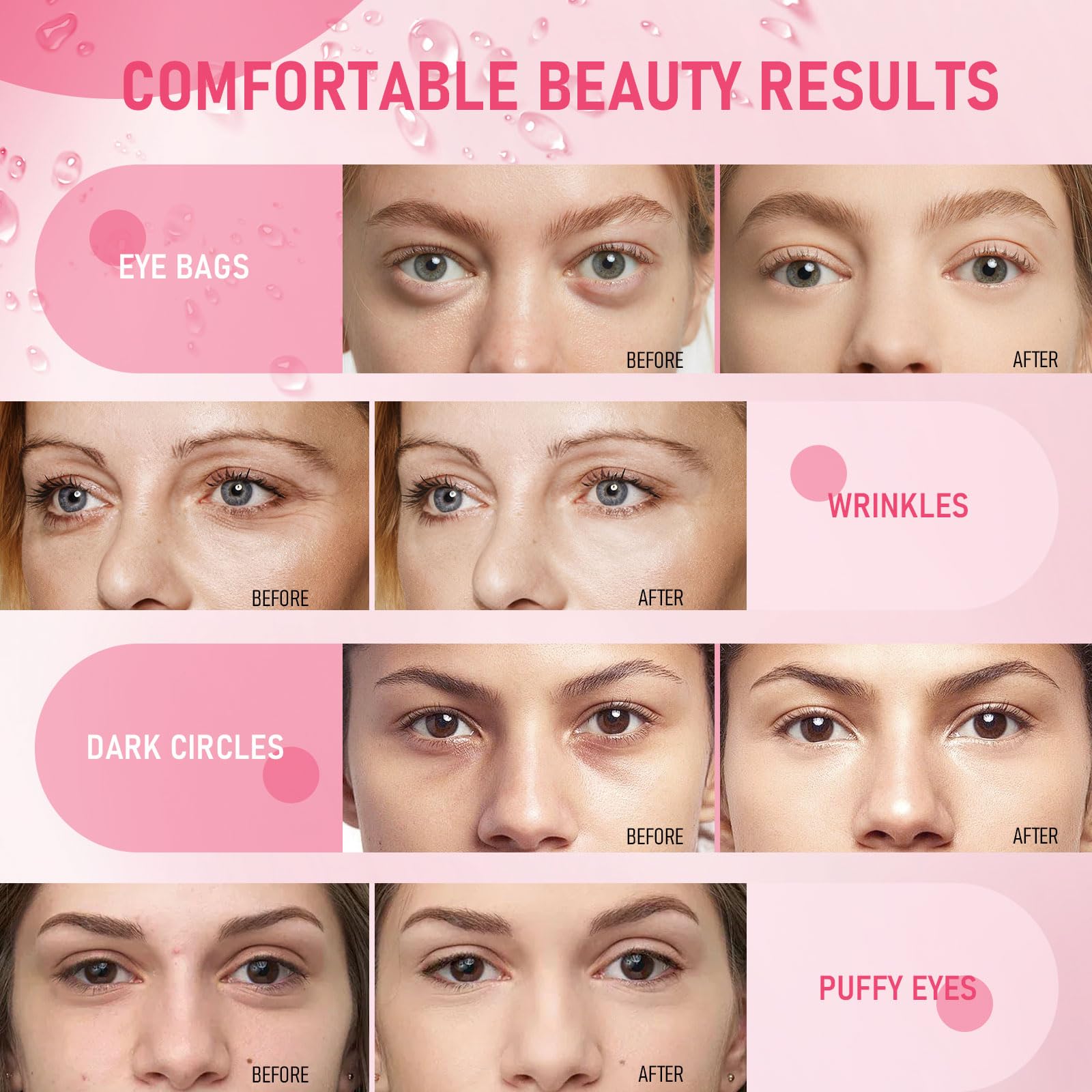 LAVONE before and after comparison demonstrating improved eye texture