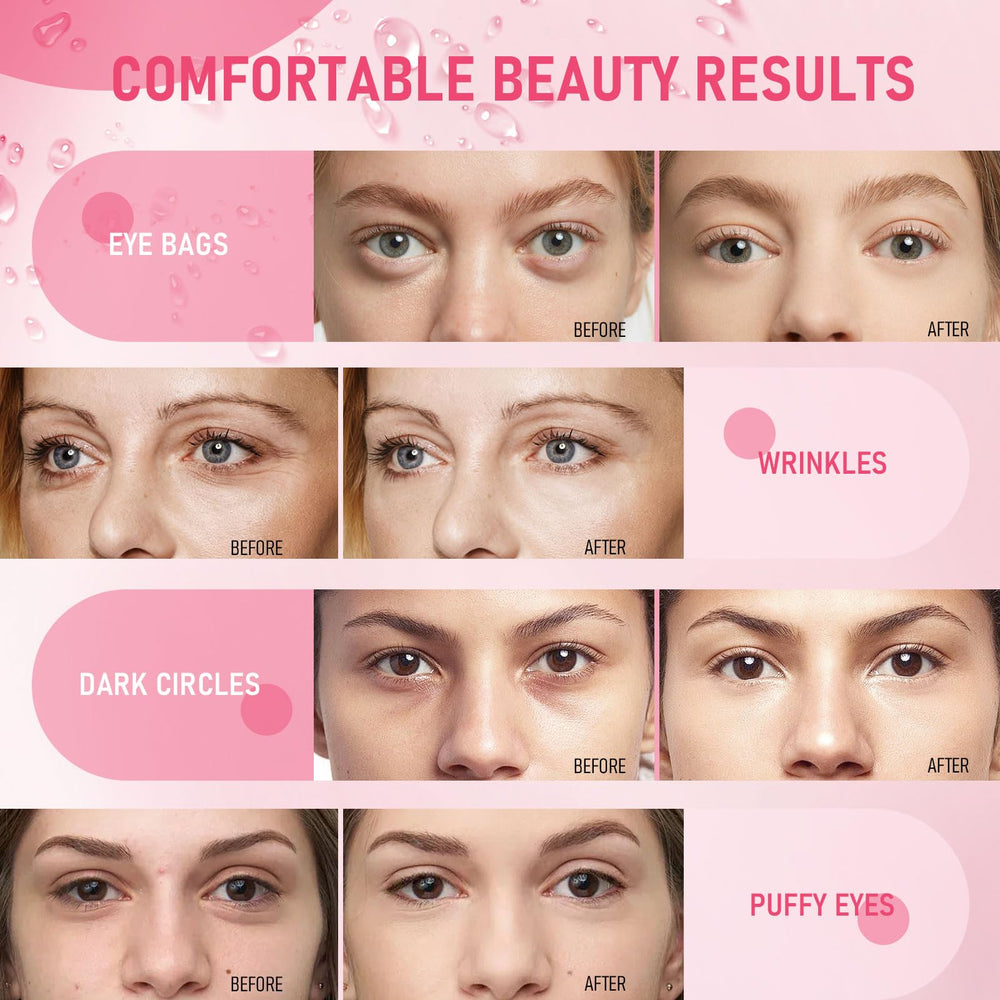 LAVONE before and after comparison demonstrating improved eye texture