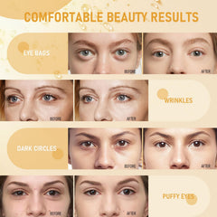 LAVONE before and after under-eye comparison showing smoother skin