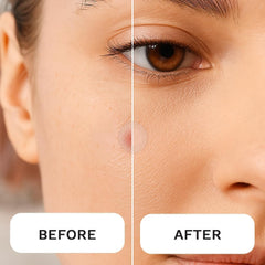 LE GUSHE patch applied on cheek demonstrating discreet protection benefit