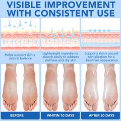 liiutry back label with ingredients list highlighting urea and salicylic acid