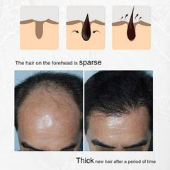 LINEDSON applying spray to scalp encouraging targeted follicle care