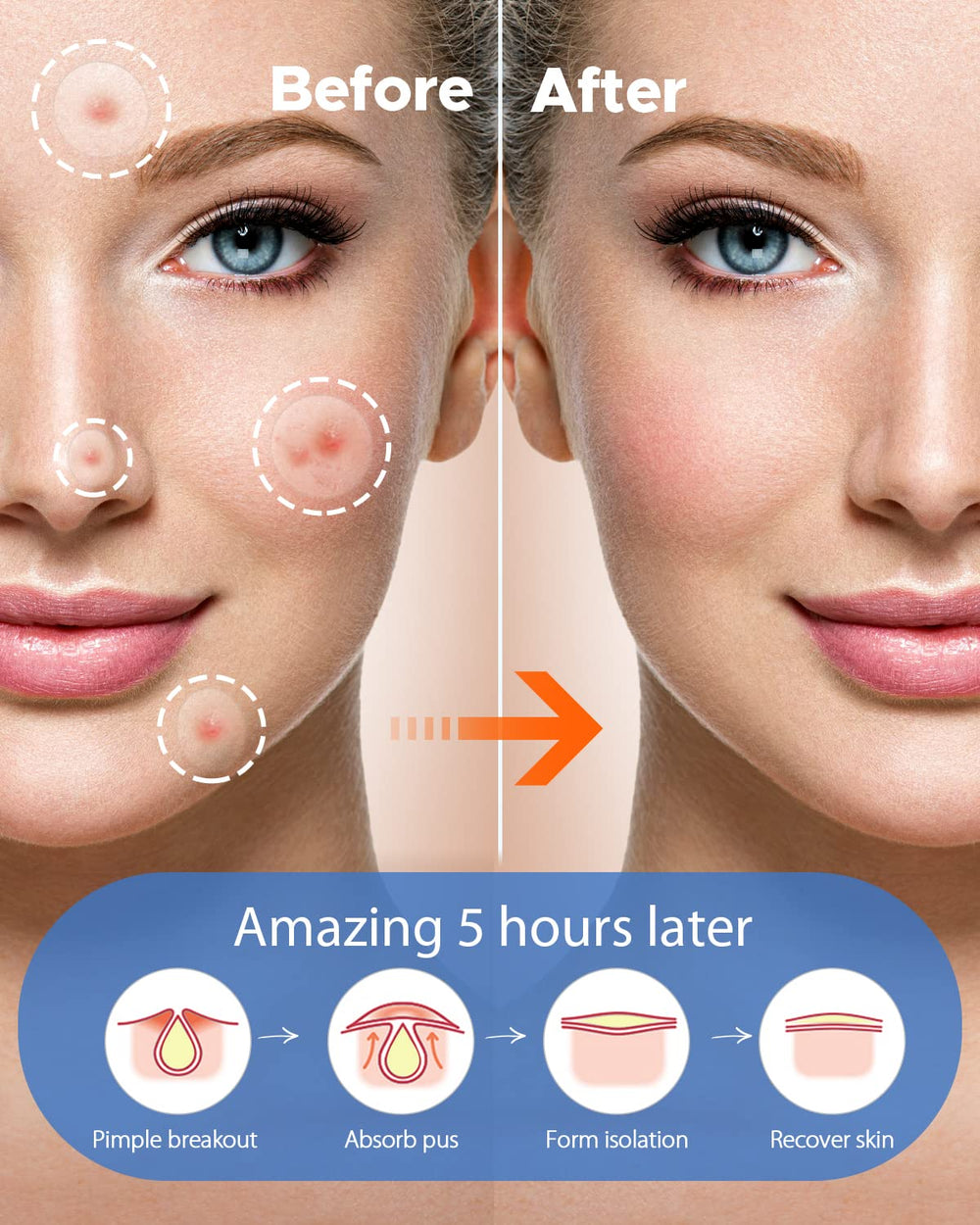 LitBear thin day patch under makeup providing discreet coverage