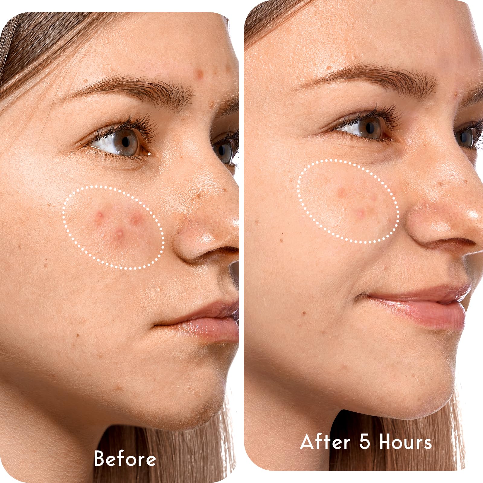 LitBear hydrocolloid texture detail highlighting strong absorption