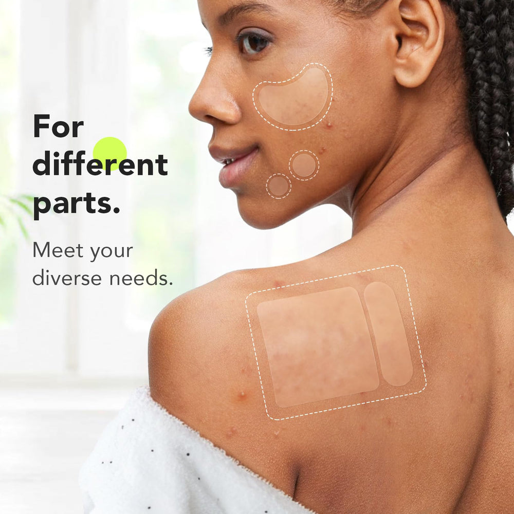 LitBear XL square patch detail highlighting coverage for large blemishes