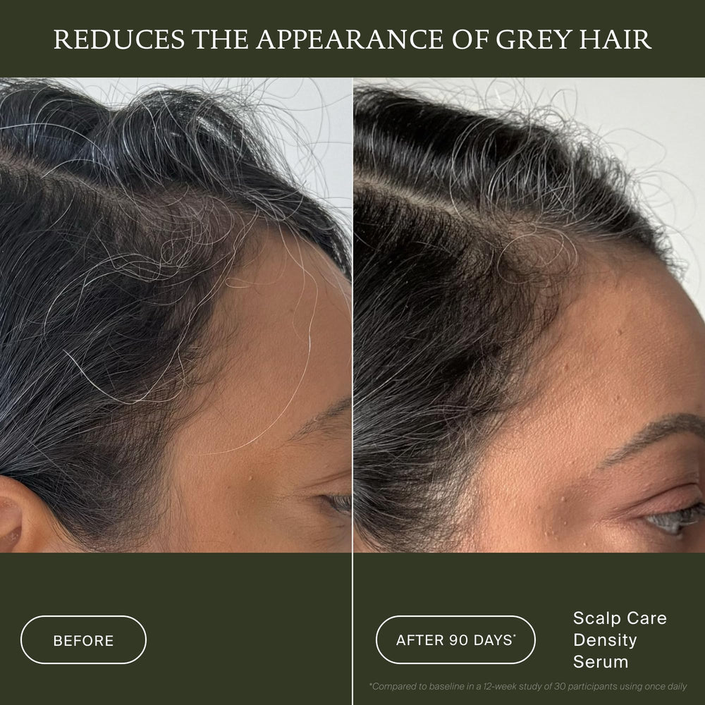 Living Proof before and after comparison illustrating increased visible hair density
