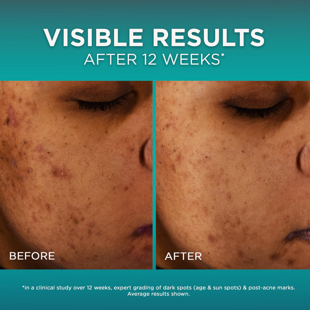 L'Oréal Paris Bright Reveal product label focused on niacinamide and ferulic ingredients