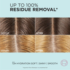 L'Oreal Paris before and after scalp image showing reduced oil benefit