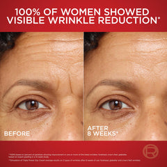 L'Oreal Paris cream being applied on hand demonstrating easy absorption benefit