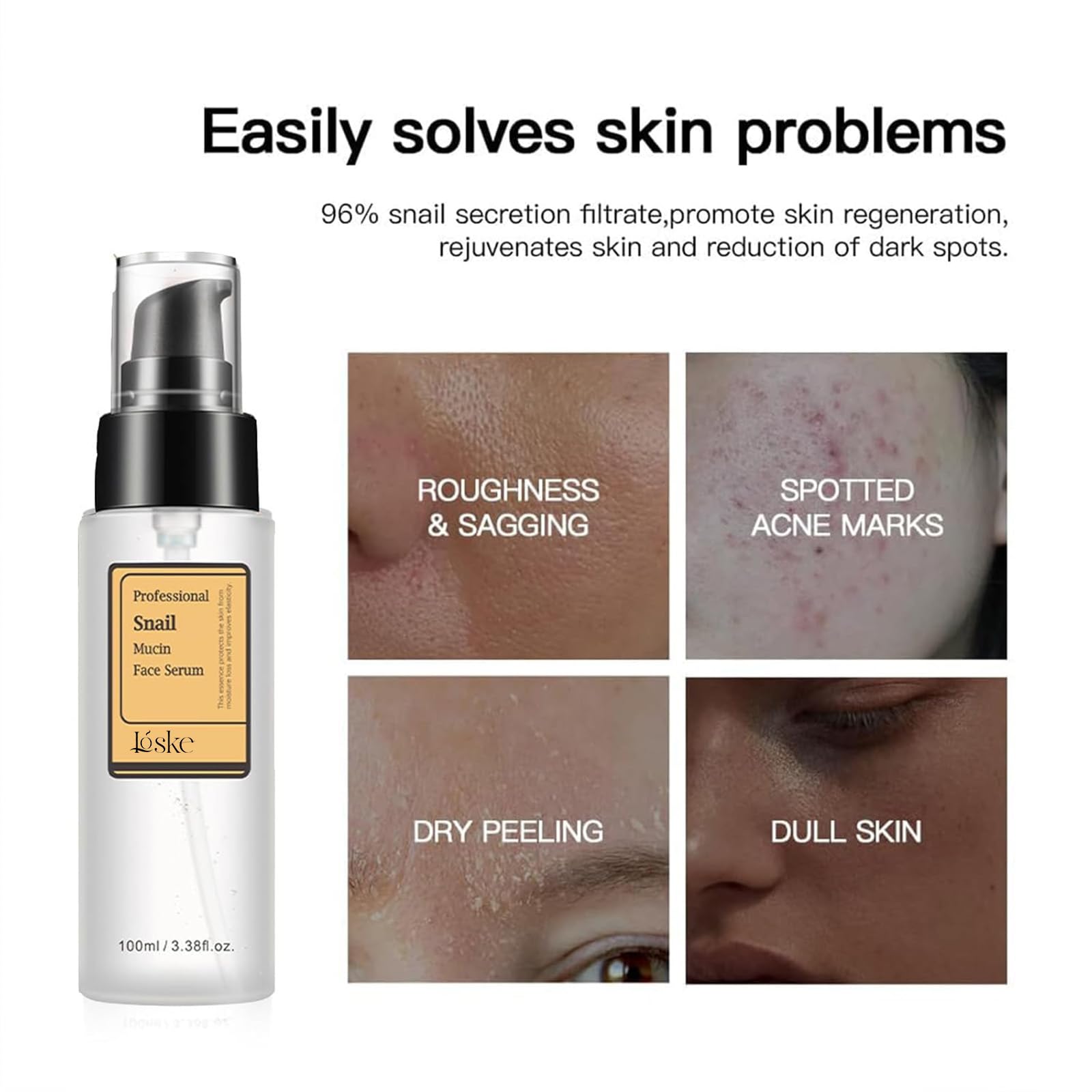 Loske bottle beside common skincare tube showing product size and scale
