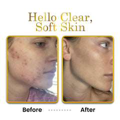 Luxe Beauty applied to hands to relieve dryness and improve skin softness