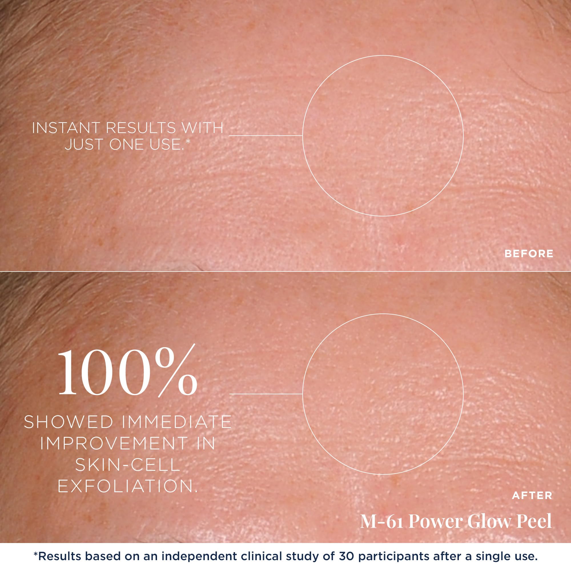 m-61 pad in hand demonstrating size and quick one-minute treatment