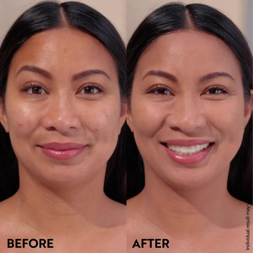 M. Asam before and after portrait showing reduced redness and spots